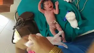 NURSE CLEANING NEW BORN BABY ,JUST AFTER BIRTH PROCEDURE l NEWBORN BABY CLEANING l INDIAN BABY