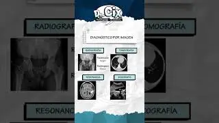 Términos básicos en radiología