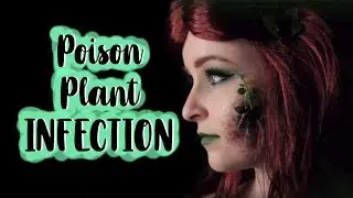 Poison Plant Infection SFX Makeup Tutorial | Fox & Crown