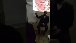БОТУЛАКС. Коррекция m.masseter