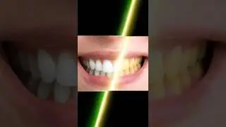 How whiten teeth in photoshop  
