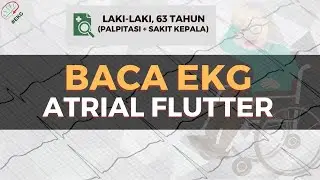 BACA EKG (ATRIAL FLUTTER) | EP.7