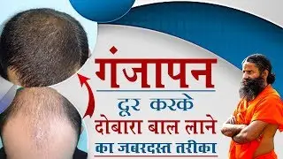 गंजापन दूर करके दोबारा बाल लाने का जबरदस्त तरीका | Swami Ramdev