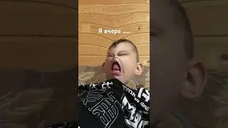 Сломал руку☠️💀