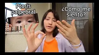 Mi hija tiene una condición congénita en su ojo
