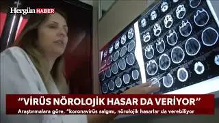 "Virüs nörolojik hasar da veriyor"
