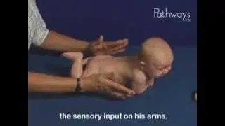 2 Month Old Babies Typical and Atypical Development in Prone (lying face down on tummy)
