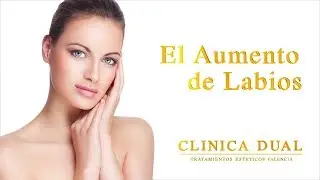 AUMENTO DE LABIOS - Antes y Después