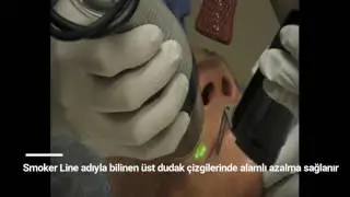 Lazer Cilt Gençleştirme Cilt Yenileme