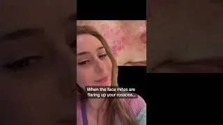 Rosacea Solution 