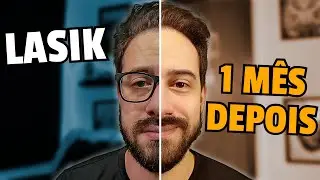 Como foi a cirurgia que MUDOU A MINHA VIDA 👓 [Miopia/Astigmatismo]