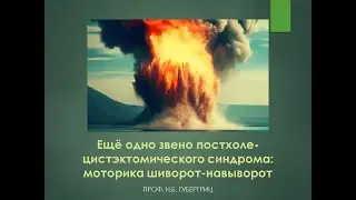 Ещё одно звено постхолецистэктомического синдрома: моторика шиворот-навыворот