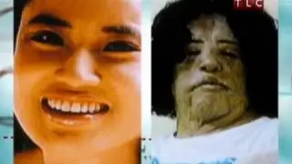 Моя ужасная история. Жертвы пластической хирургии