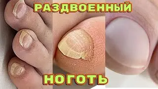 Не стриг ногти 😱 Мужской педикюр / Как сделать чистый педикюр