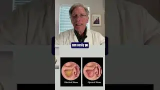 How Allergens and Dirty Air Cause Sinus Pain!