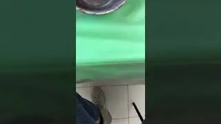 Рана , поранил палец, разрезал палец, зашили рану , шитье раны , порез ножом