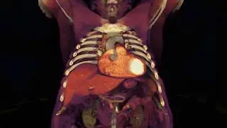 Beyond a CT Scan