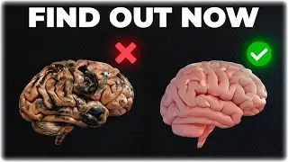 Porn Brain Quiz: Are You An Actual Addict?
