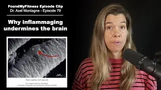 Why inflammation causes dementia — brain effects of inflammaging