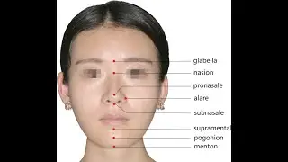 Anatomy of the Nasion // Bridge of the nose