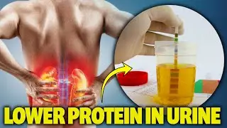 How To Lower Protein in urine, Proteinuria & Improve Kidney Health & Kidney Function