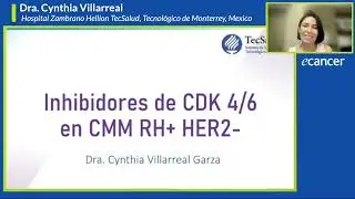 Inhibidores de CDK4/6 CMM RH-Positivo, HER2-Negativo: evidencia and recomendaciones