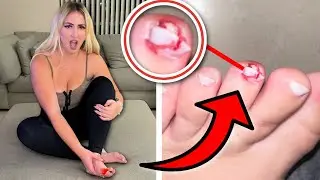 I BROKE my Foot *HELP*