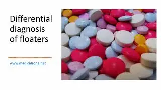Medical Zone - Differential diagnosis of floaters