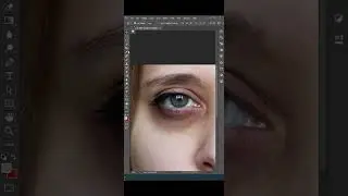 Remove Dark Circles In Photoshop #photoshoptutorial  #shorts  #photoshop