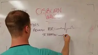 Osborn 'J' waves in Hypothermia (ECG Finding)