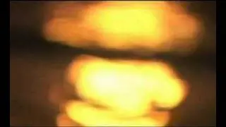 Zen Planet Relaxation Meditation