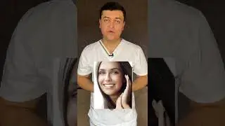 Винир