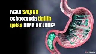 Agar SAQICH oshqozoningizga TIQILIB QOLSA Nima bo'ladi?