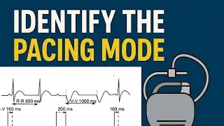 Identify Pacing Mode on ECG #cardiology #heart #electrophysiology #pacemaker 