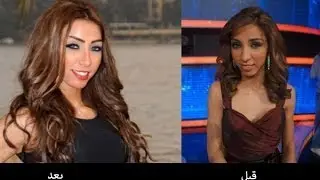 لن تصدق   شكل الفنانات المصريين والعرب قبل وبعد عمليات التجميل   سبحان مغير الأحوال