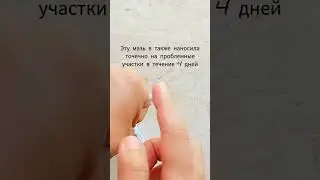 Неожиданное средство от прыщей 