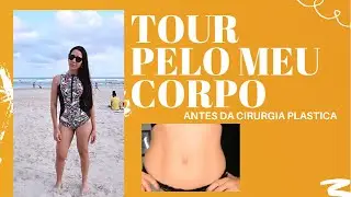 MOSTREI COMO ERA MEU CORPO ANTES DE SER DEFORMADO PELO MEDICO