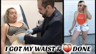 My Brazilian Butt Lift & Tummy Tuck Experience PART 2