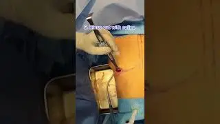 POV Breast Implant Surgery! 