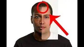 Black Man Turned White