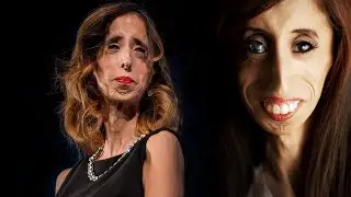 Todo Dia Existe Mulher Incel?!