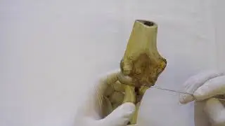 Локтевой сустав