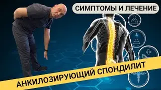 БОЛЕЗНЬ БЕХТЕРЕВА или АНКИЛОЗИРУЮЩИЙ СПОНДИЛИТ. Как распознать и чем лечить?