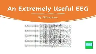 An Extremely Useful EEG