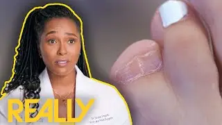 Surgery Goes Wrong As Dr Ebonie Has To Think Fast | My Feet Are Killing Me