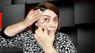 Botox  removing wrinkles around the eyes and reducing fat without surgery