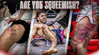 The Worst Leg Kicks Of All Time 😳