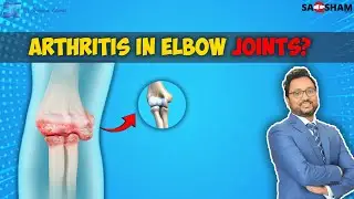 Arthritis in Elbow Joints@saqshamortho1346