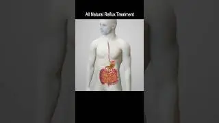 Reflux Alginate Therapy - All Natural GERD and LPR Treatment 