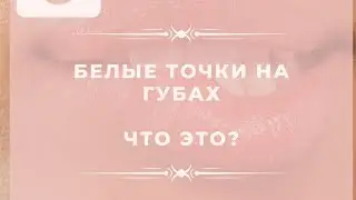 Белые точки на губах !